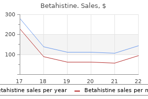 betahistine 16 mg low price