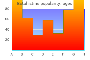 buy betahistine 16 mg on-line
