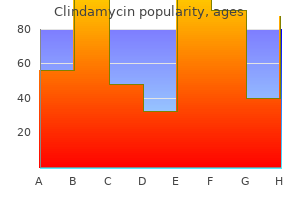 150 mg clindamycin effective