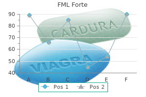 cheap 5 ml fml forte free shipping