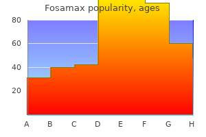 35 mg fosamax purchase free shipping