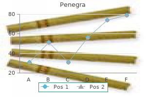 discount penegra 50 mg line