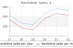 order ranitidine 300 mg free shipping